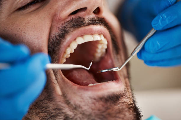 Best Cosmetic Emergency Dentistry in Forest View, IL